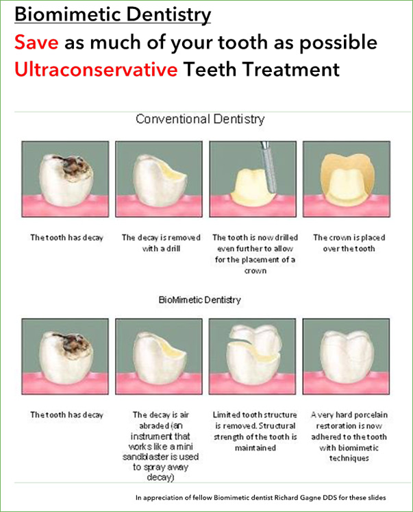 Cosmetic Dentistry San Diego